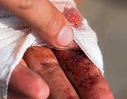 Personal Accident Insurance